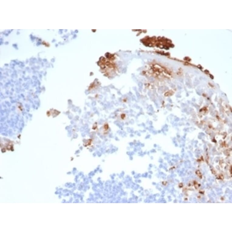 Immunohistochemistry - Anti-Myeloperoxidase Antibody [rMPO/6904] - BSA and Azide free (A278490) - Antibodies.com