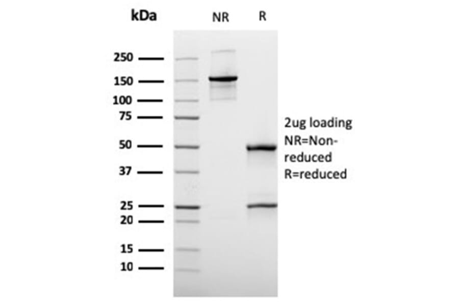 Immunohistochemistry - Anti-MUC3 Antibody [rMUC3/1154] - BSA and Azide free (A278491) - Antibodies.com