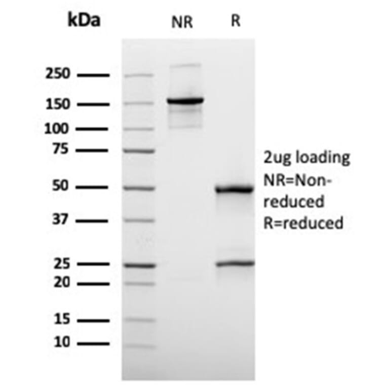 Immunohistochemistry - Anti-MUC3 Antibody [rMUC3/1154] - BSA and Azide free (A278491) - Antibodies.com