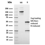 Immunohistochemistry - Anti-MUC3 Antibody [rMUC3/1154] - BSA and Azide free (A278491) - Antibodies.com