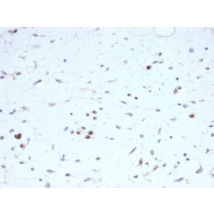 Immunohistochemistry - Anti-MyoD1 Antibody [rMYOD1/6911] - BSA and Azide free (A278492) - Antibodies.com