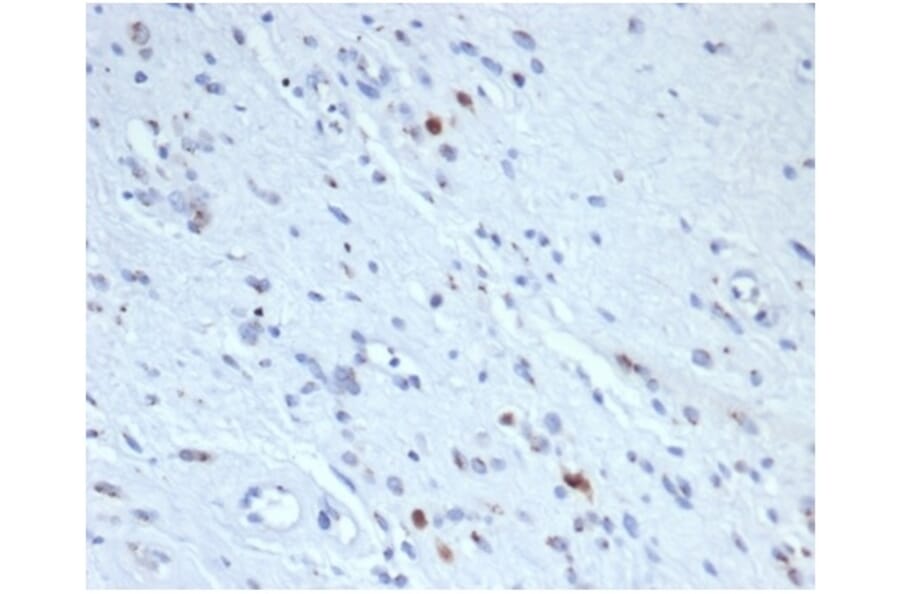 Immunohistochemistry - Anti-Myogenin Antibody [rMYOG/6297] - BSA and Azide free (A278493) - Antibodies.com