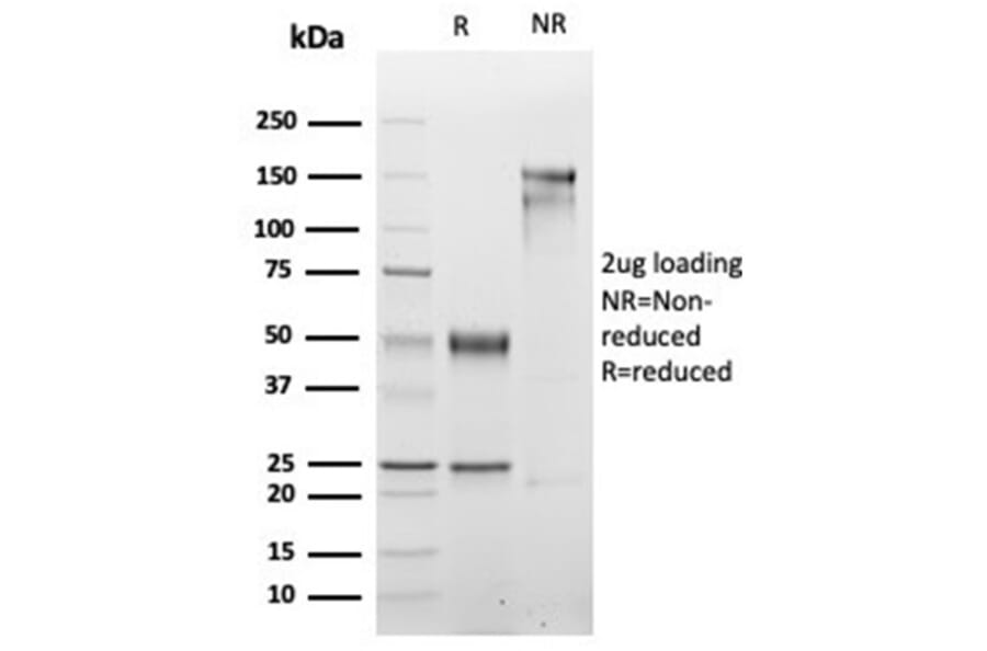 SDS-PAGE - Anti-Myogenin Antibody [rMYOG/6297] - BSA and Azide free (A278493) - Antibodies.com