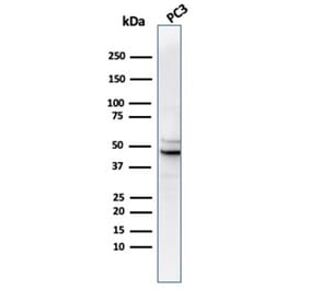 Western Blot - Anti-Ornithine Decarboxylase Antibody [rODC1/487] - BSA and Azide free (A278494) - Antibodies.com