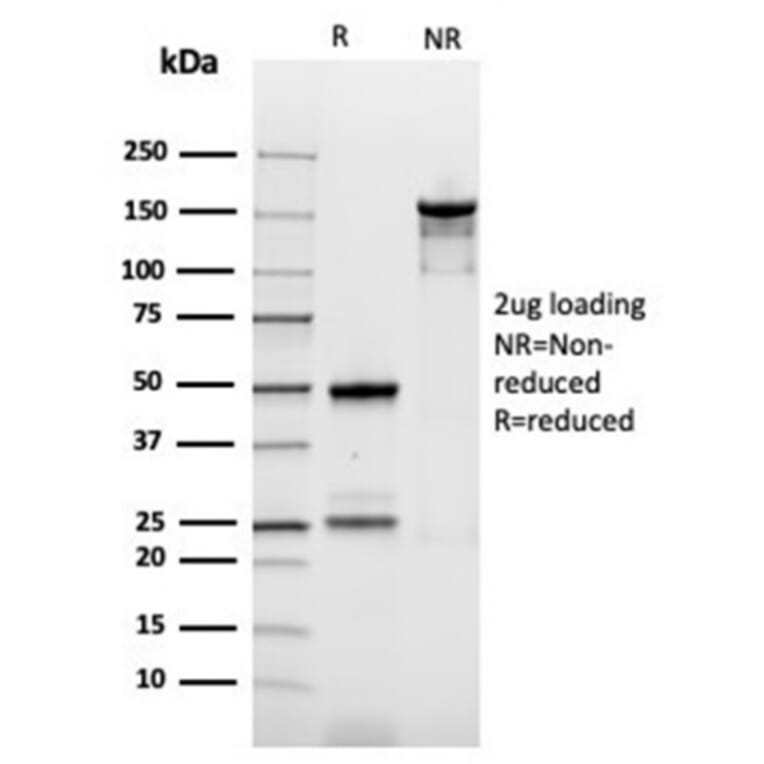SDS-PAGE - Anti-Ornithine Decarboxylase Antibody [rODC1/487] - BSA and Azide free (A278494) - Antibodies.com