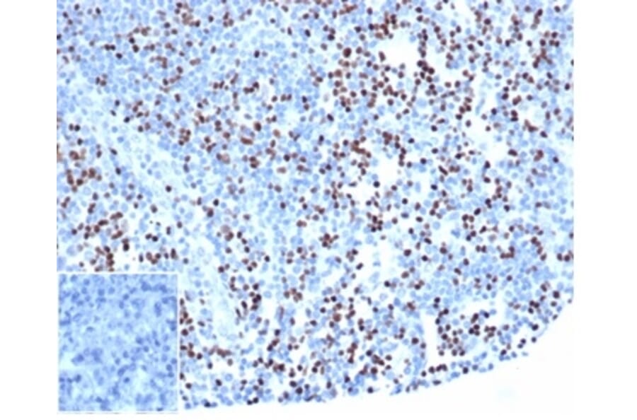 Immunohistochemistry - Anti-LEF1 Antibody [rLEF1/6906] - BSA and Azide free (A278495) - Antibodies.com