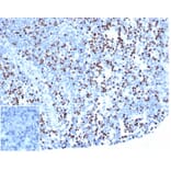 Immunohistochemistry - Anti-LEF1 Antibody [rLEF1/6906] - BSA and Azide free (A278495) - Antibodies.com