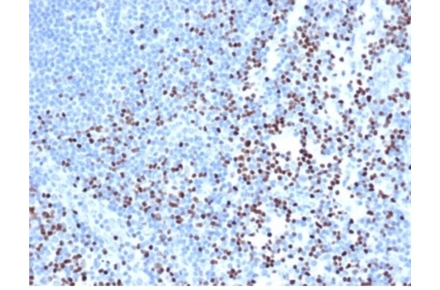 Immunohistochemistry - Anti-LEF1 Antibody [rLEF1/6906] - BSA and Azide free (A278495) - Antibodies.com