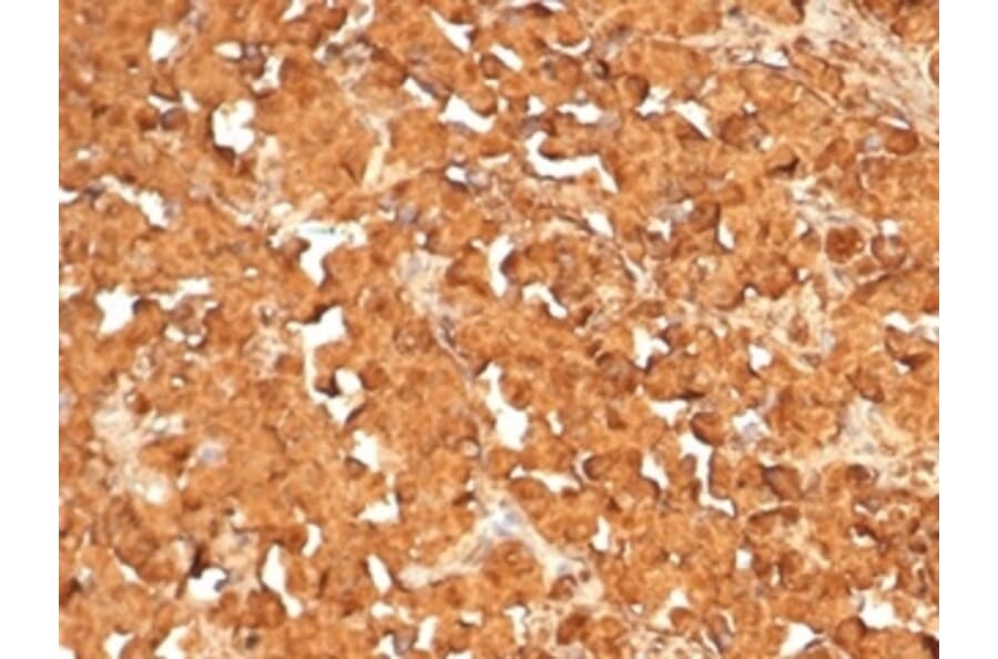 Immunohistochemistry - Anti-ACTH Antibody [rCLIP4278] - BSA and Azide free (A278498) - Antibodies.com