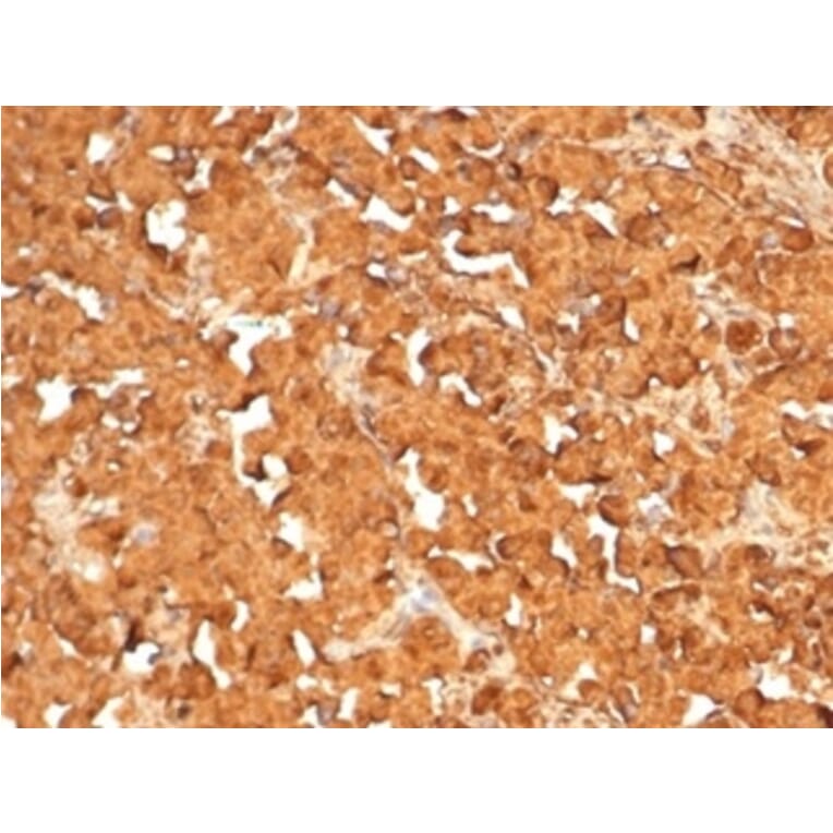 Immunohistochemistry - Anti-ACTH Antibody [rCLIP4278] - BSA and Azide free (A278498) - Antibodies.com