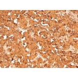 Immunohistochemistry - Anti-ACTH Antibody [rCLIP4278] - BSA and Azide free (A278498) - Antibodies.com