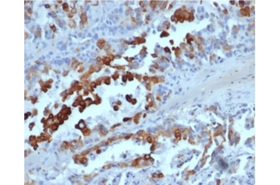 Immunohistochemistry - Anti-Cytokeratin 20 Antibody [rKRT20/6536] - BSA and Azide free (A278499) - Antibodies.com