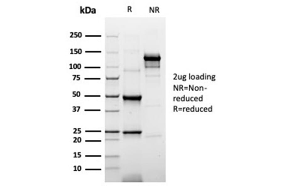 SDS-PAGE - Anti-Cytokeratin 20 Antibody [rKRT20/6536] - BSA and Azide free (A278499) - Antibodies.com