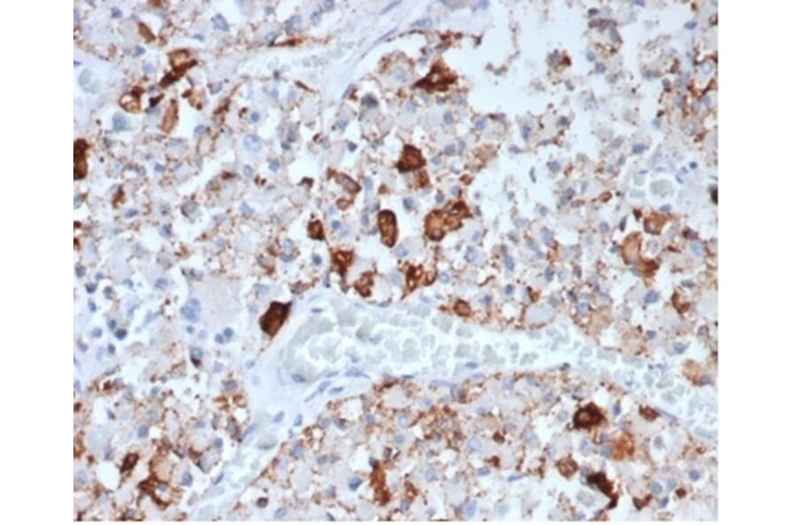 Immunohistochemistry - Anti-Prolactin Antibody [rPRL/4907] - BSA and Azide free (A278500) - Antibodies.com