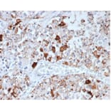 Immunohistochemistry - Anti-Prolactin Antibody [rPRL/4907] - BSA and Azide free (A278500) - Antibodies.com
