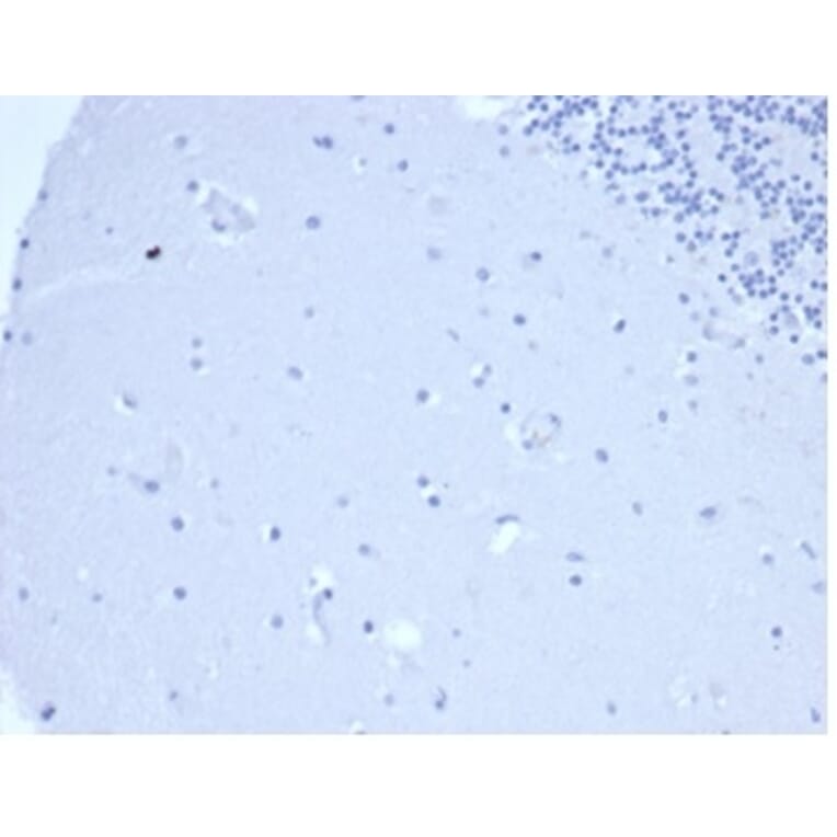 Immunohistochemistry - Anti-Prolactin Antibody [rPRL/4907] - BSA and Azide free (A278500) - Antibodies.com