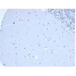 Immunohistochemistry - Anti-Prolactin Antibody [rPRL/4907] - BSA and Azide free (A278500) - Antibodies.com
