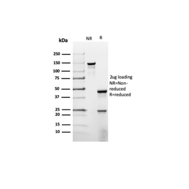SDS-PAGE - Anti-Prolactin Antibody [rPRL/4907] - BSA and Azide free (A278500) - Antibodies.com