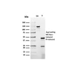 SDS-PAGE - Anti-Prolactin Antibody [rPRL/4907] - BSA and Azide free (A278500) - Antibodies.com