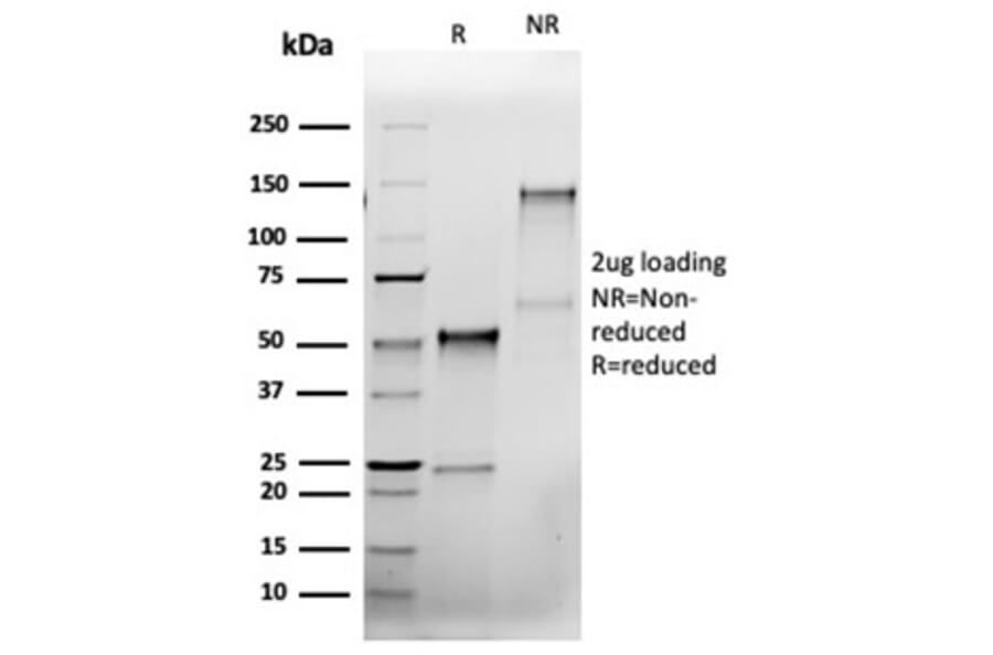 SDS-PAGE - Anti-Bcl-X Antibody [rBCL2L1/4508] - BSA and Azide free (A278502) - Antibodies.com