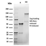 SDS-PAGE - Anti-Bcl-X Antibody [rBCL2L1/4508] - BSA and Azide free (A278502) - Antibodies.com