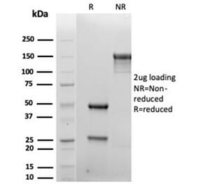 SDS-PAGE - Anti-Syndecan 1 Antibody [rSDC1/6866] - BSA and Azide free (A278503) - Antibodies.com