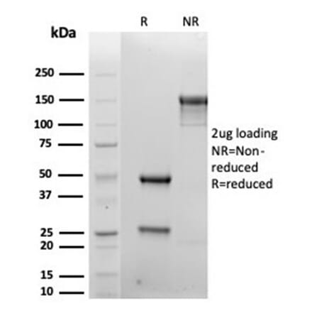 SDS-PAGE - Anti-Syndecan 1 Antibody [rSDC1/6866] - BSA and Azide free (A278503) - Antibodies.com