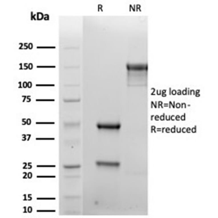 SDS-PAGE - Anti-Syndecan 1 Antibody [rSDC1/6866] - BSA and Azide free (A278503) - Antibodies.com