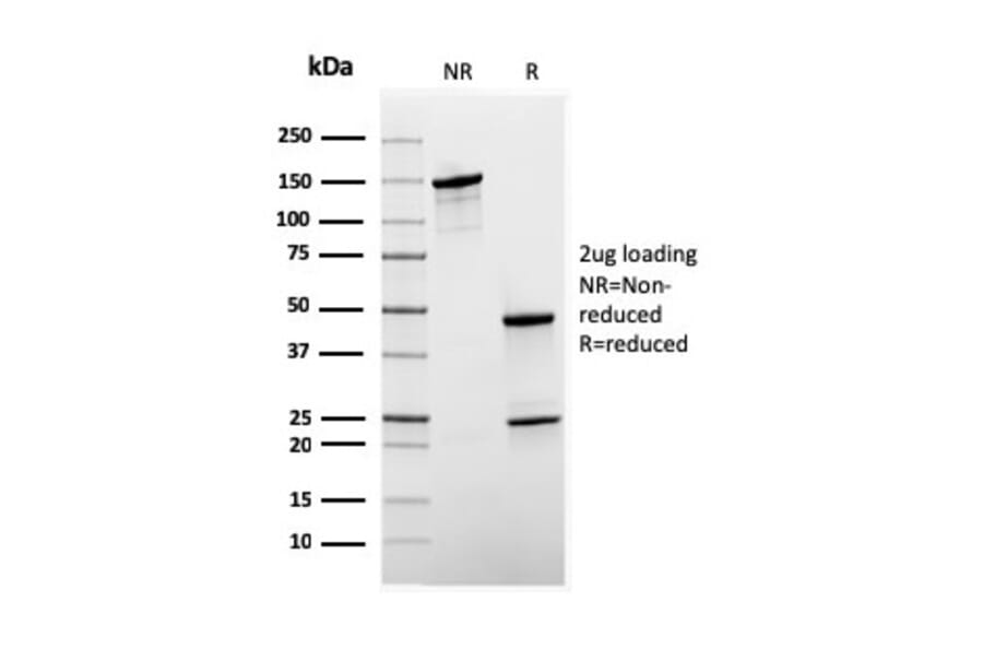 SDS-PAGE - Anti-Sex Hormone Binding Globulin Antibody [rSHBG-245] - BSA and Azide free (A278504) - Antibodies.com