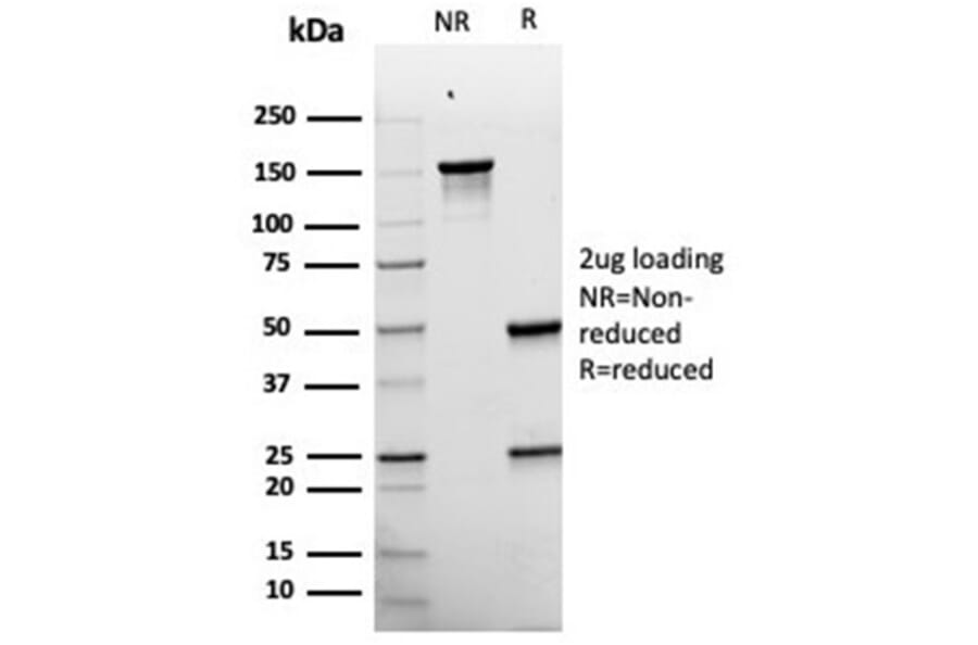 SDS-PAGE - Anti-Melanoma gp100 Antibody [rPMEL17/6821] - BSA and Azide free (A278506) - Antibodies.com