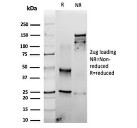 SDS-PAGE - Anti-Fascin Antibody [rFSCN1/6464] - BSA and Azide free (A278507) - Antibodies.com