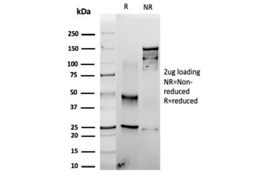 SDS-PAGE - Anti-Fascin Antibody [rFSCN1/6464] - BSA and Azide free (A278507) - Antibodies.com