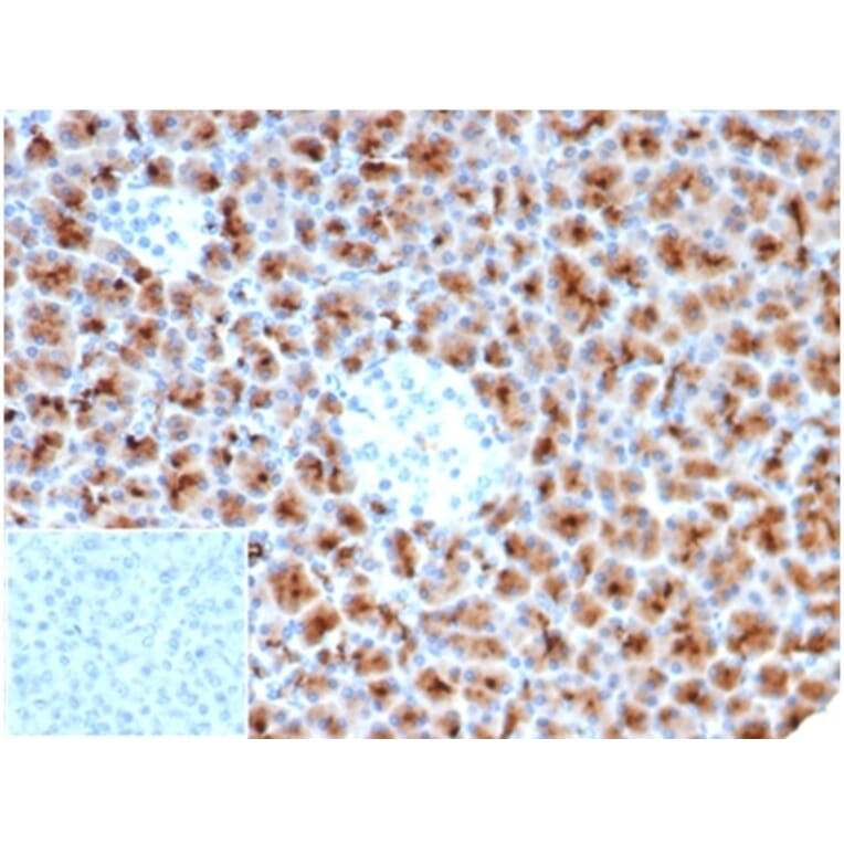 Immunohistochemistry - Anti-Fascin Antibody [rFSCN1/6464] - BSA and Azide free (A278507) - Antibodies.com