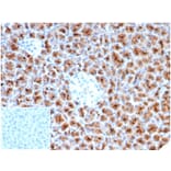 Immunohistochemistry - Anti-Fascin Antibody [rFSCN1/6464] - BSA and Azide free (A278507) - Antibodies.com