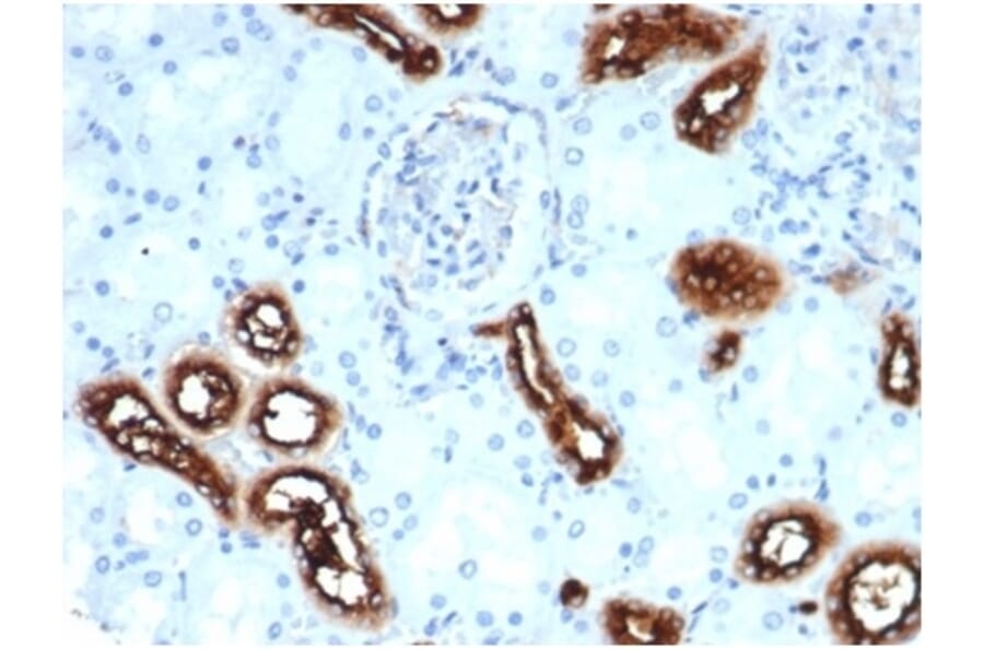 Immunohistochemistry - Anti-Fascin Antibody [rFSCN1/6464] - BSA and Azide free (A278507) - Antibodies.com