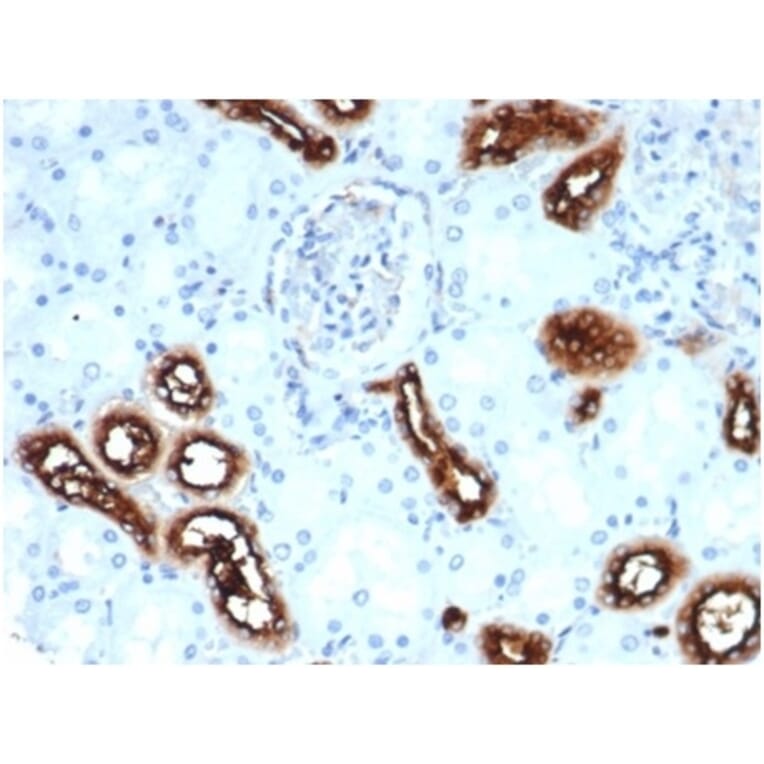 Immunohistochemistry - Anti-Fascin Antibody [rFSCN1/6464] - BSA and Azide free (A278507) - Antibodies.com