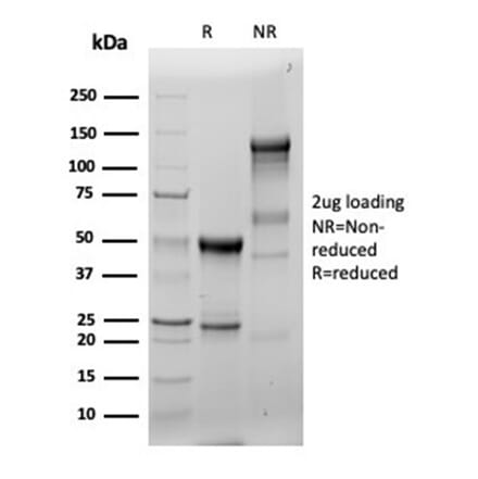 SDS-PAGE - Anti-Fascin Antibody [FSCN1/6465R] - BSA and Azide free (A278508) - Antibodies.com