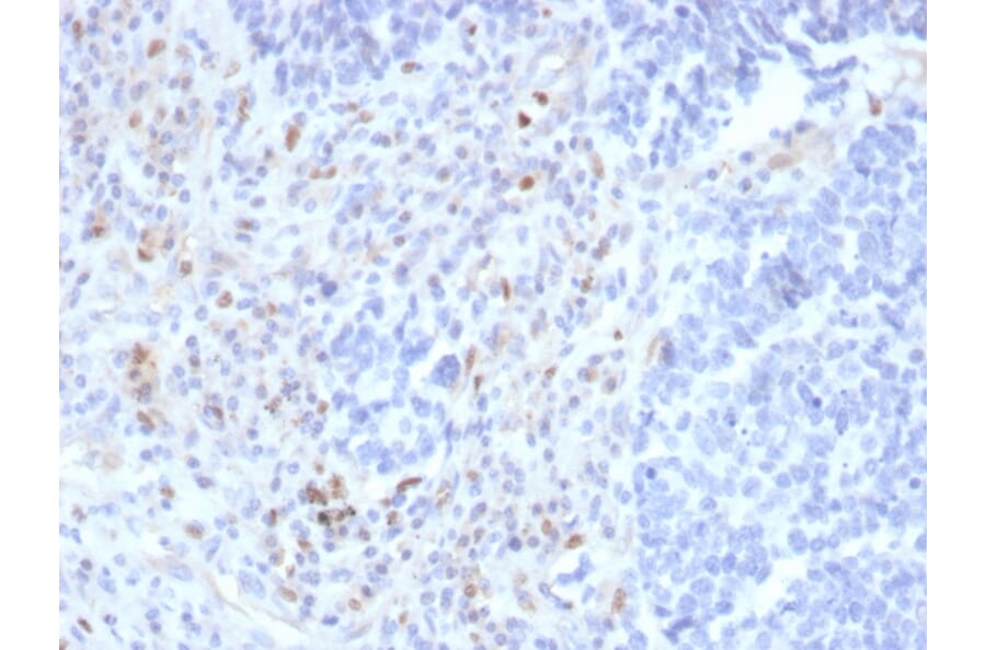 Immunohistochemistry - Anti-PU.1 Antibody [rPU1/2146] - BSA and Azide free (A278510) - Antibodies.com