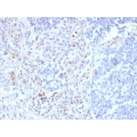 Immunohistochemistry - Anti-PU.1 Antibody [rPU1/2146] - BSA and Azide free (A278510) - Antibodies.com