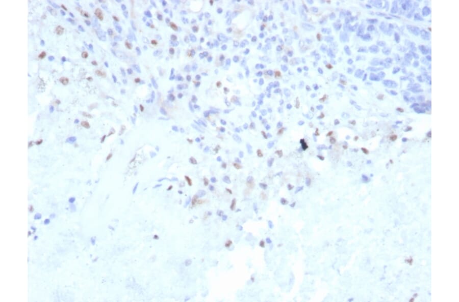 Immunohistochemistry - Anti-PU.1 Antibody [rPU1/2146] - BSA and Azide free (A278510) - Antibodies.com