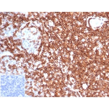 Immunohistochemistry - Anti-CD43 Antibody [rSPN/6563] - BSA and Azide free (A278511) - Antibodies.com