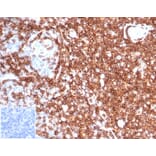Immunohistochemistry - Anti-CD43 Antibody [rSPN/6563] - BSA and Azide free (A278511) - Antibodies.com