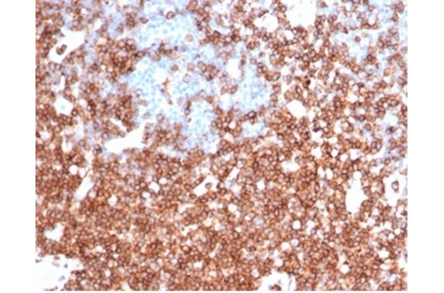 Immunohistochemistry - Anti-CD43 Antibody [rSPN/6563] - BSA and Azide free (A278511) - Antibodies.com