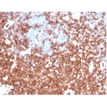 Immunohistochemistry - Anti-CD43 Antibody [rSPN/6563] - BSA and Azide free (A278511) - Antibodies.com