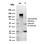 SDS-PAGE - Anti-CD43 Antibody [rSPN/6563] - BSA and Azide free (A278511) - Antibodies.com