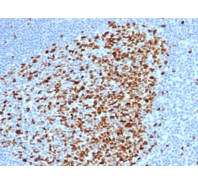 Immunohistochemistry - Anti-Topoisomerase II alpha Antibody [rTOP2A/6569] - BSA and Azide free (A278513) - Antibodies.com