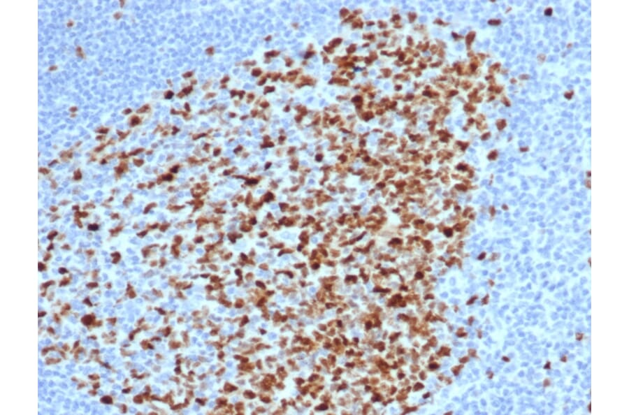 Immunohistochemistry - Anti-Topoisomerase II alpha Antibody [rTOP2A/6569] - BSA and Azide free (A278513) - Antibodies.com