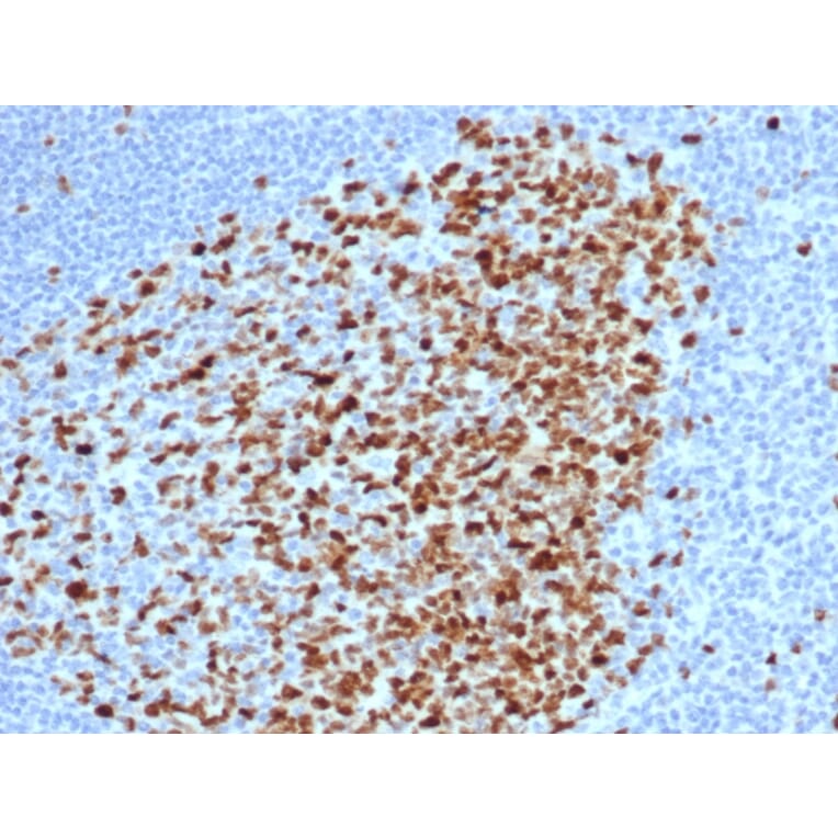 Immunohistochemistry - Anti-Topoisomerase II alpha Antibody [rTOP2A/6569] - BSA and Azide free (A278513) - Antibodies.com