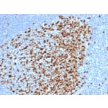 Immunohistochemistry - Anti-Topoisomerase II alpha Antibody [rTOP2A/6569] - BSA and Azide free (A278513) - Antibodies.com