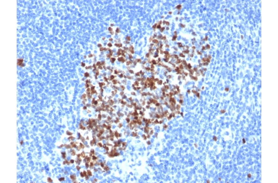 Immunohistochemistry - Anti-Topoisomerase II alpha Antibody [rTOP2A/6569] - BSA and Azide free (A278513) - Antibodies.com